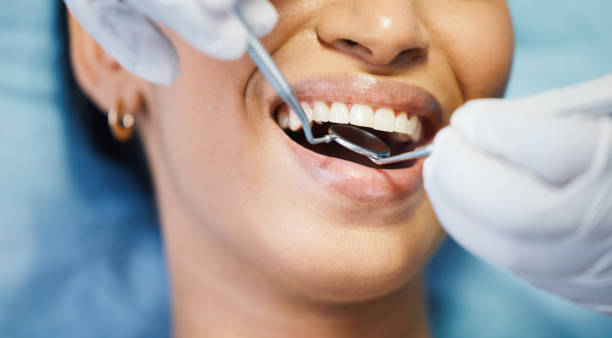 Best Emergency Gum Pain Relief  in Mexico, MO